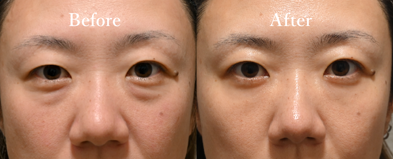 The head of a hospital MOHRI MASATO