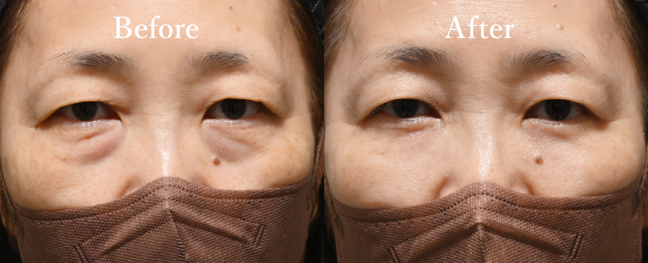 The head of a hospital MOHRI MASATO