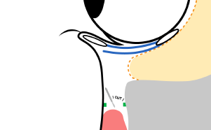 目元を横から見た状態