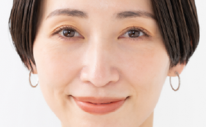 隔膜を破り、眼窩脂肪弁、隔膜・CPF前葉複合弁を作成