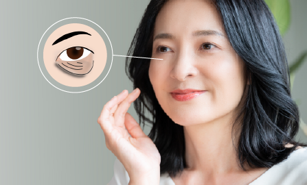 Improving Sagging and Wrinkles