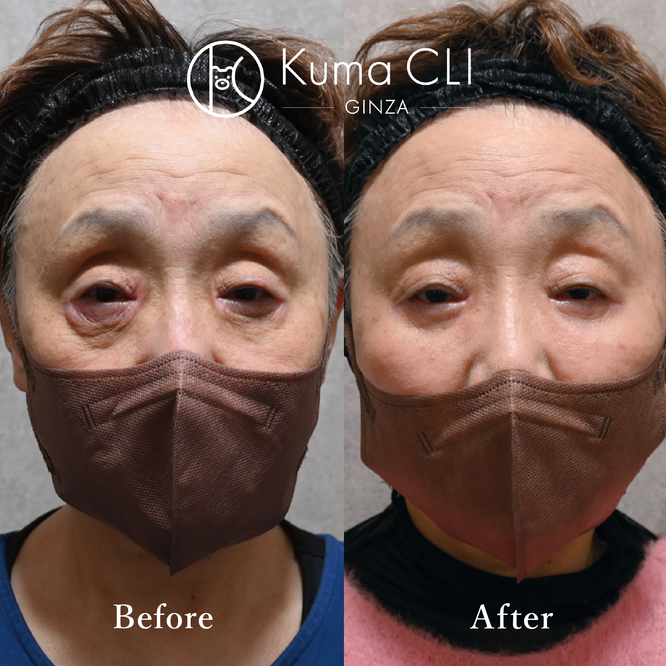 クマ治療症例写真