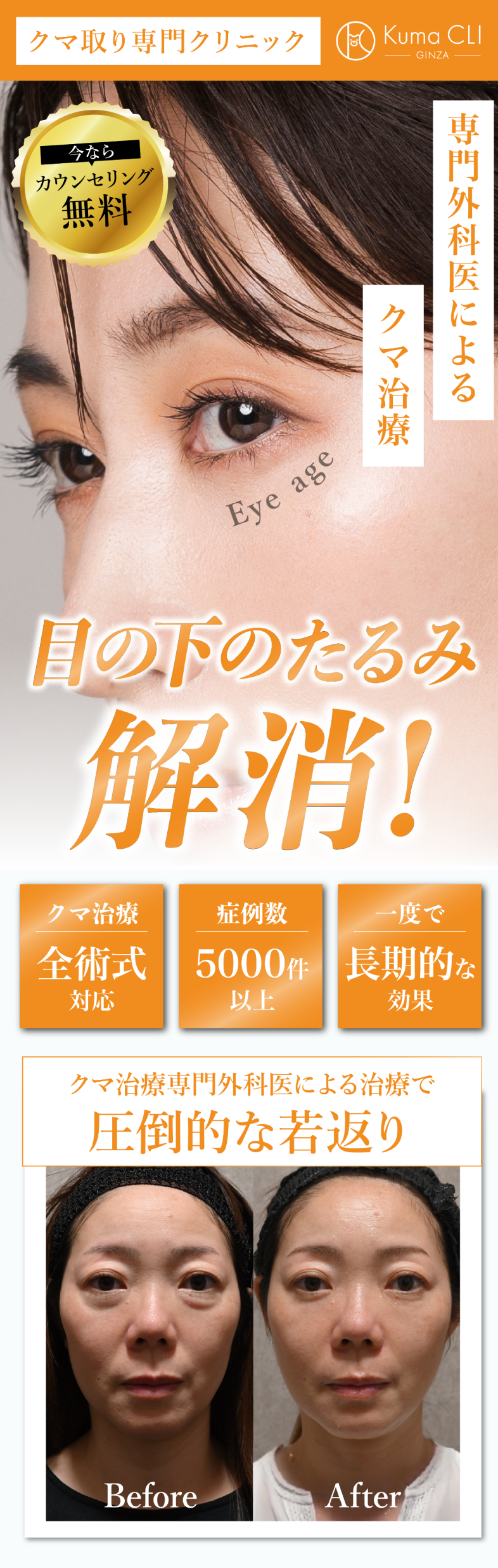 目の下のたるみ解消