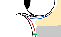 施術の流れ
