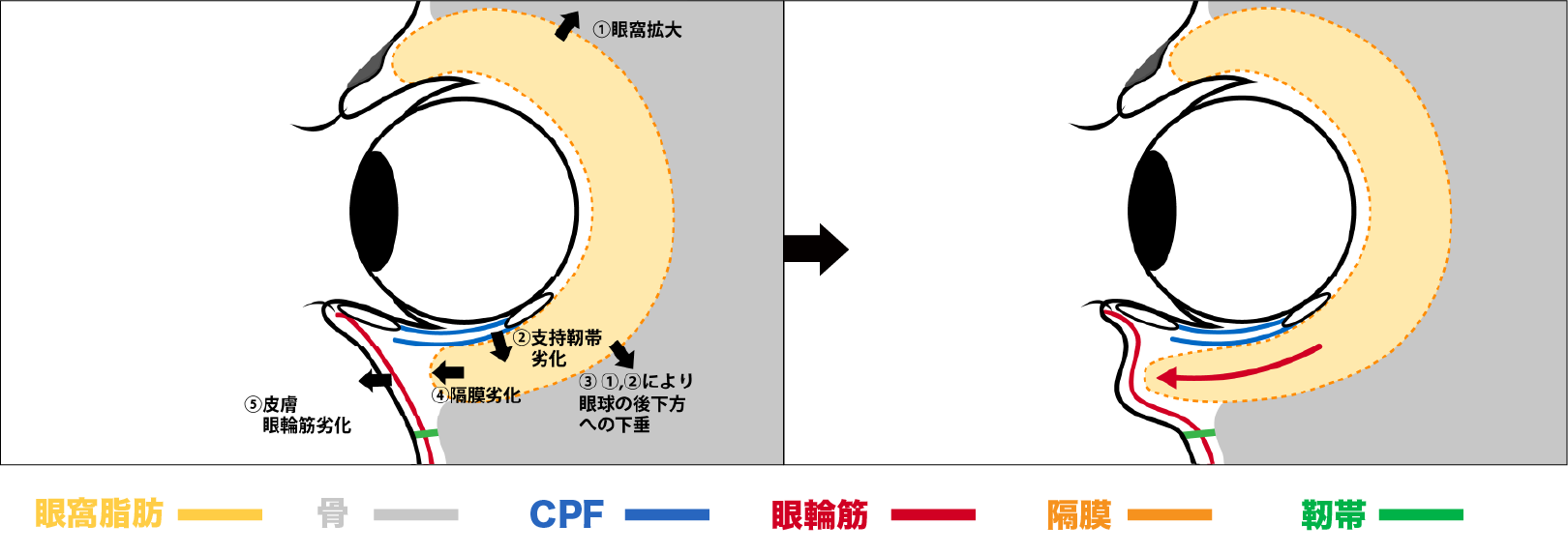 表ハムラ法