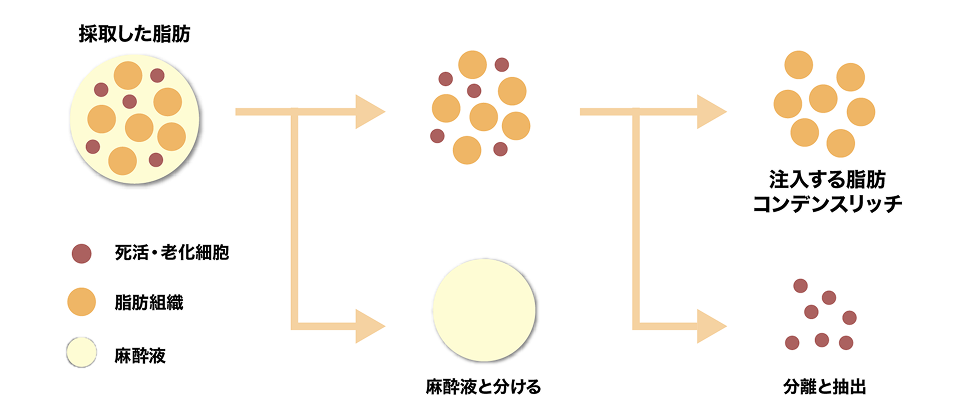 脂肪注入が適応な方