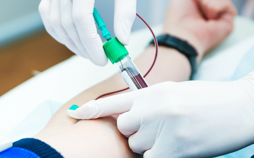 PRPの施術の流れ