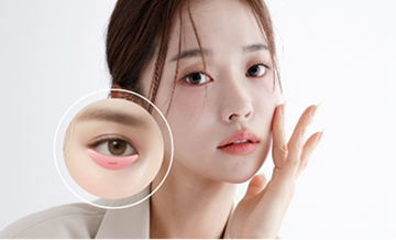 目元の印象を自然に変える