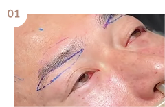 デザイン＆治療の流れを説明