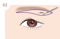 麻酔＆治療開始