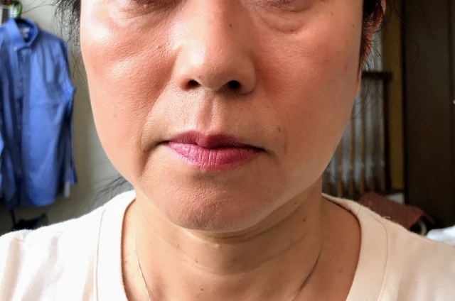 自宅で目の下のクマを治す方法ある？自宅でできるクマのセルフケアについて詳しく解説