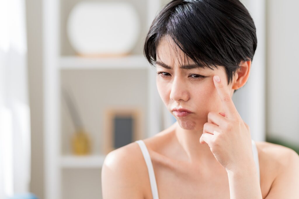 目の下にたるみができる原因