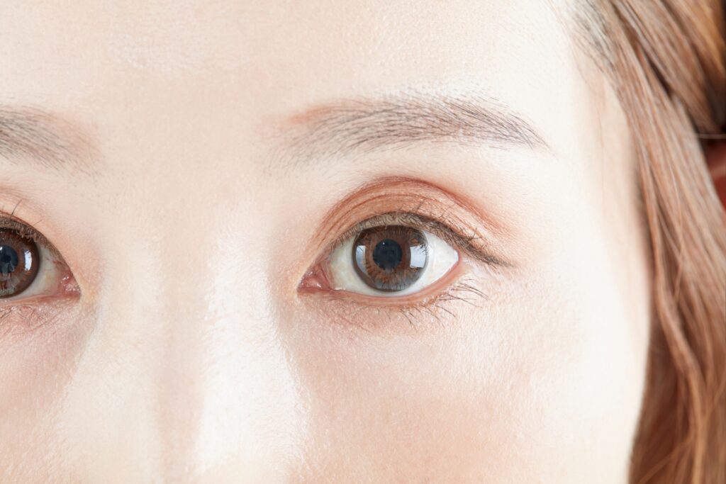 目の下のたるみによる印象の違いは？