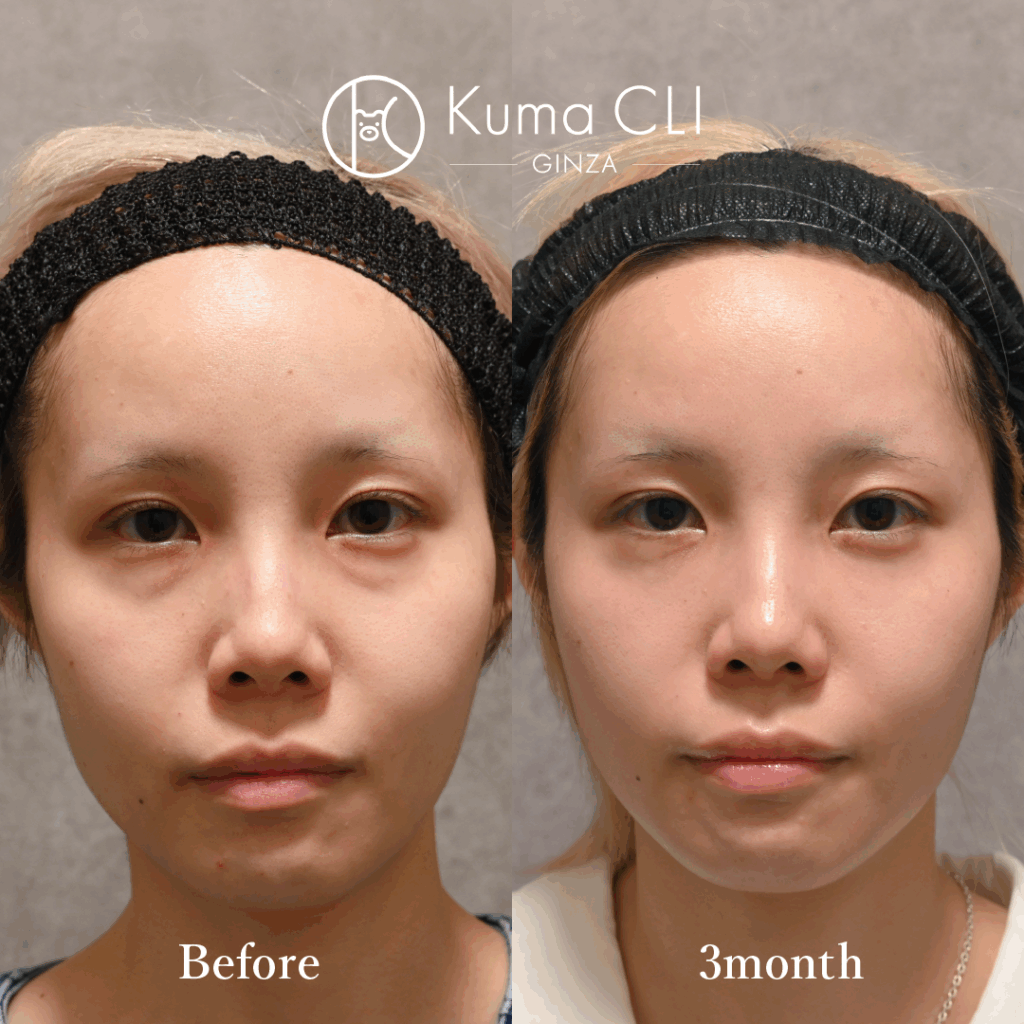 画像に alt 属性が指定されていません。ファイル名: unnamed-1024x1024.png